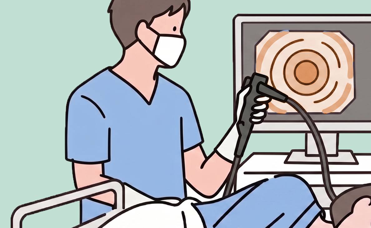 大腸カメラ検査とは